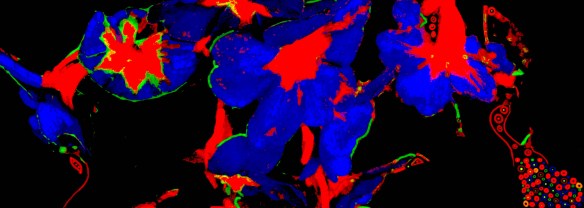 Chakra0601CorDiagnosisRec